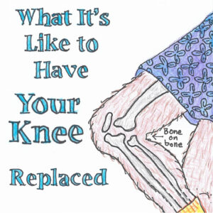What It's Like to Have Your Knee Replaced